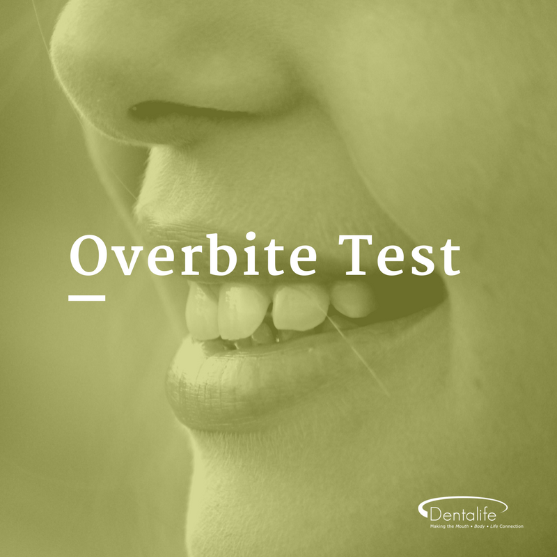 Overbite Test – Testing Yourself for TMJ and Jaw Problems