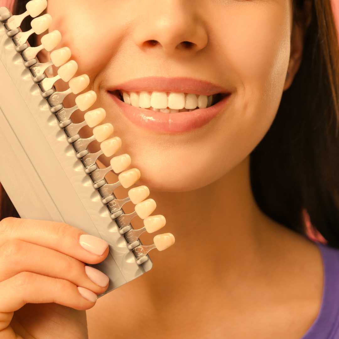 Dental Veneers Calgary Downtown Dentalife