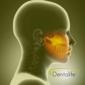 tmj-pain-dentalife-calgary-dentist